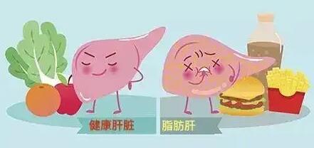 纯素饮食能预防脂肪肝？专家：人体营养需均衡