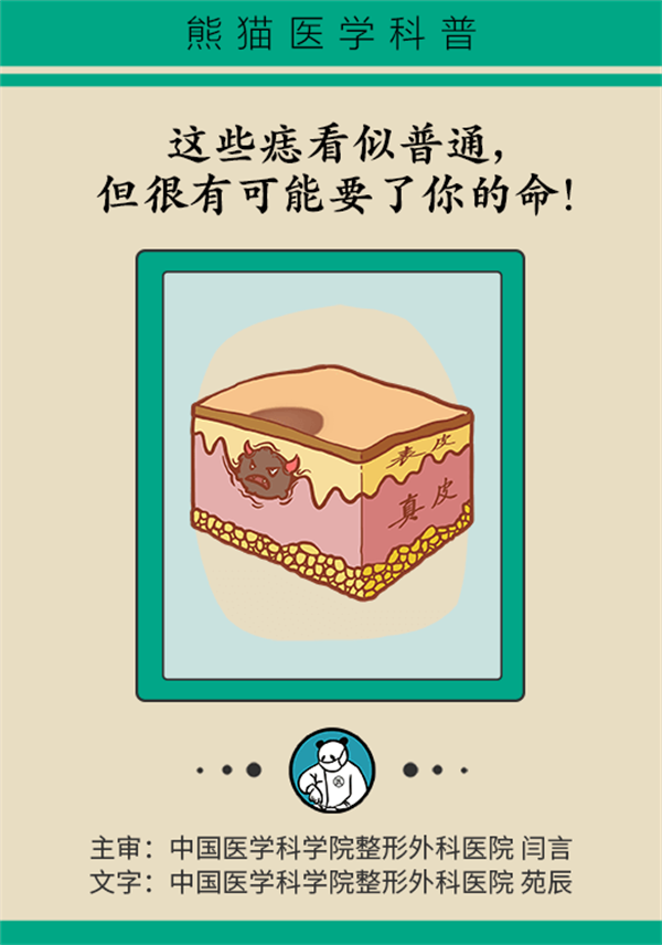 后天长出来的痣更危险？警惕五个特点的痣易癌变